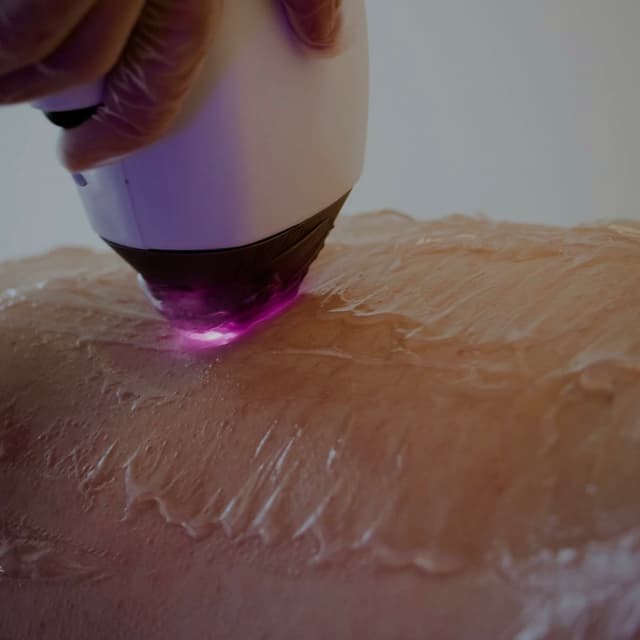 CE LASER CLUB: LVL 3 at CE SKIN GARDEN in Middletown, NY