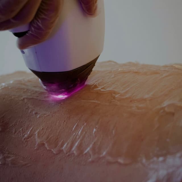 CE LASER CLUB: LVL 2 at CE SKIN GARDEN in Middletown, NY